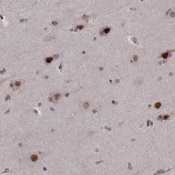 Proteasome 19S S7 Antibody, Novus Biologicals 0.1mL; Unlabeled:Antibodies,